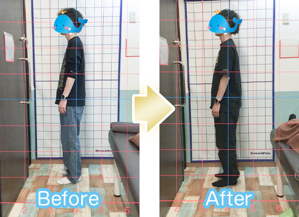 猫背ビフォーアフター