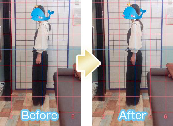 猫背ビフォーアフター